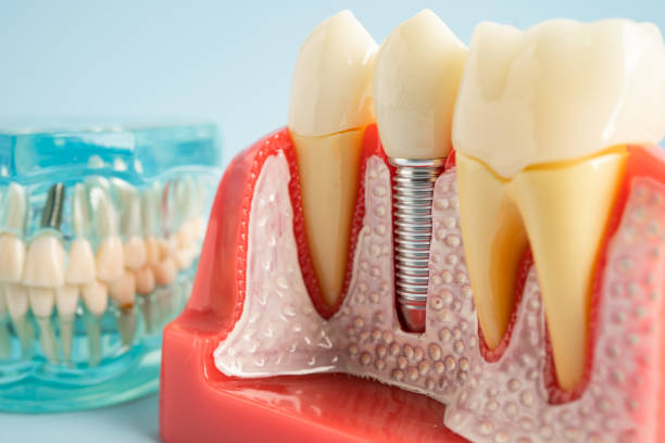 Our Range of Dental Services in Youngsville, LA